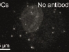Confocal pictures