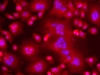 Fluorescence pictures